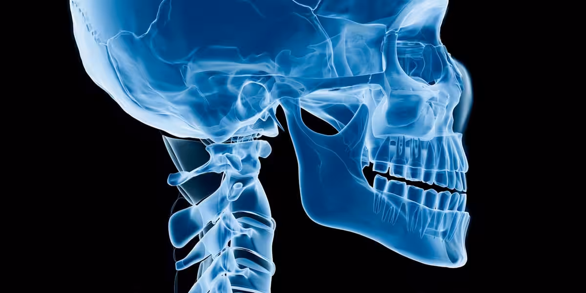 Orthognathic Surgery