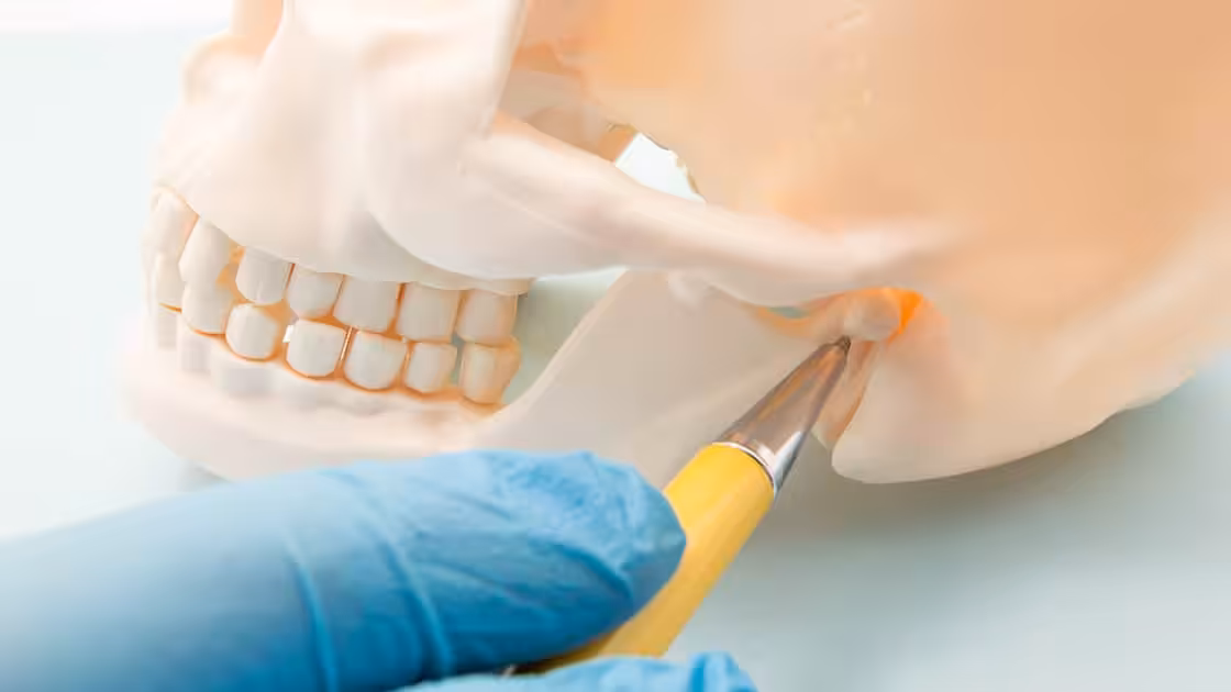 Tmj disorders image